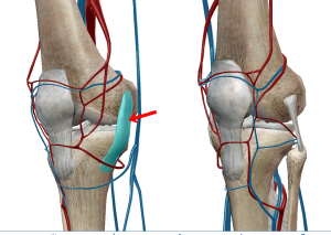 medial-c-l